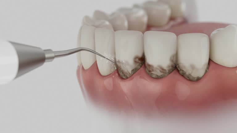 Reliable Dental contractor in El Sobrante, CA by Dentist Open Now